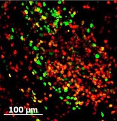 Immunocytochemistry/Immunofluorescence: GFP Antibody [FITC] [NB100-1183] - Staining of mouse spleen cells Tissue: spleen cells infected with MHV68-H2bYFP. As seen in: Collins CM, Speck SH (2012) Tracking Murine Gammaherpesvirus 68 Infection of Germinal Center B Cells.